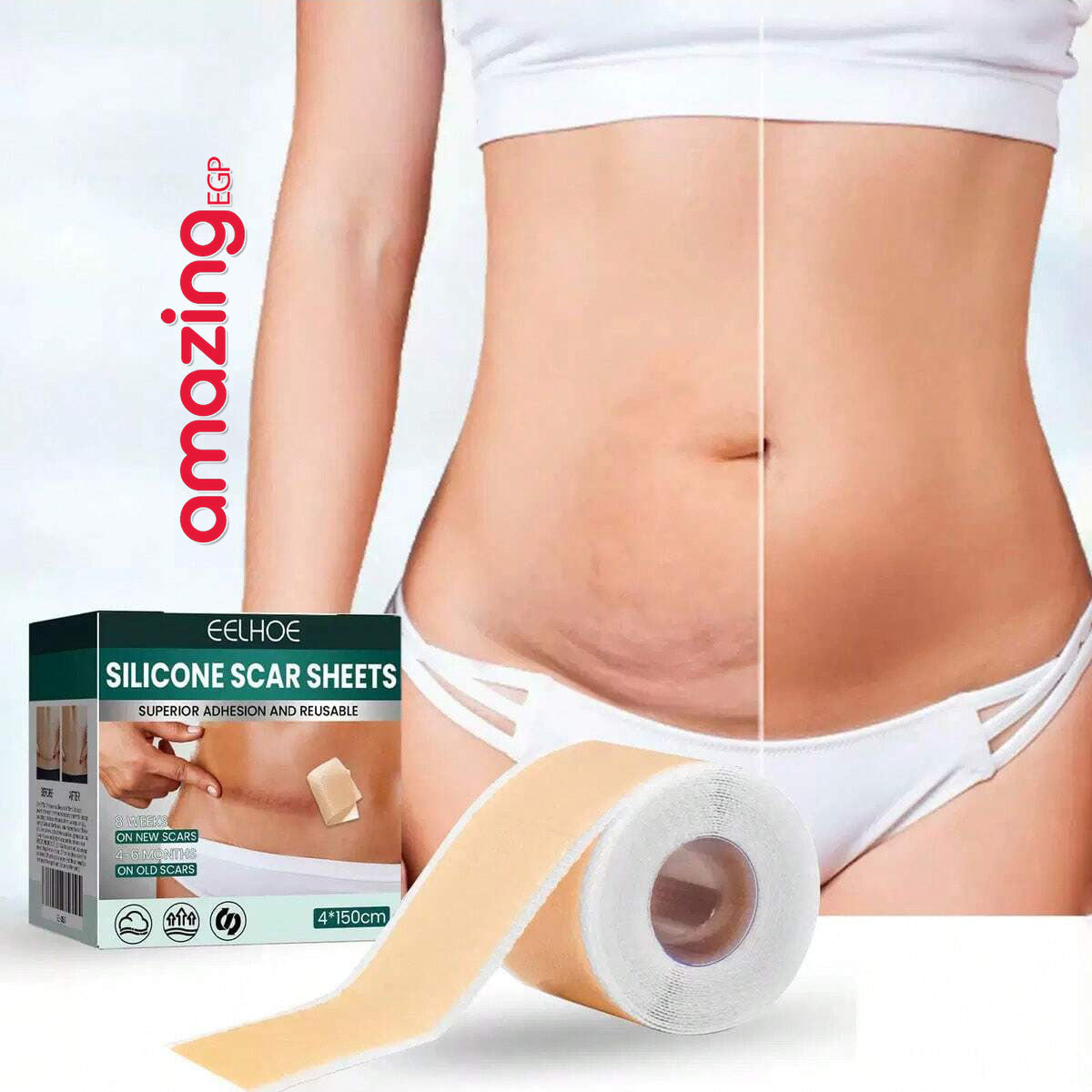 شرائح سيليكون طبية للندبات – شريط سيليكون لإزالة آثار الجروح والعمليات (4 سم × 150 سم)
