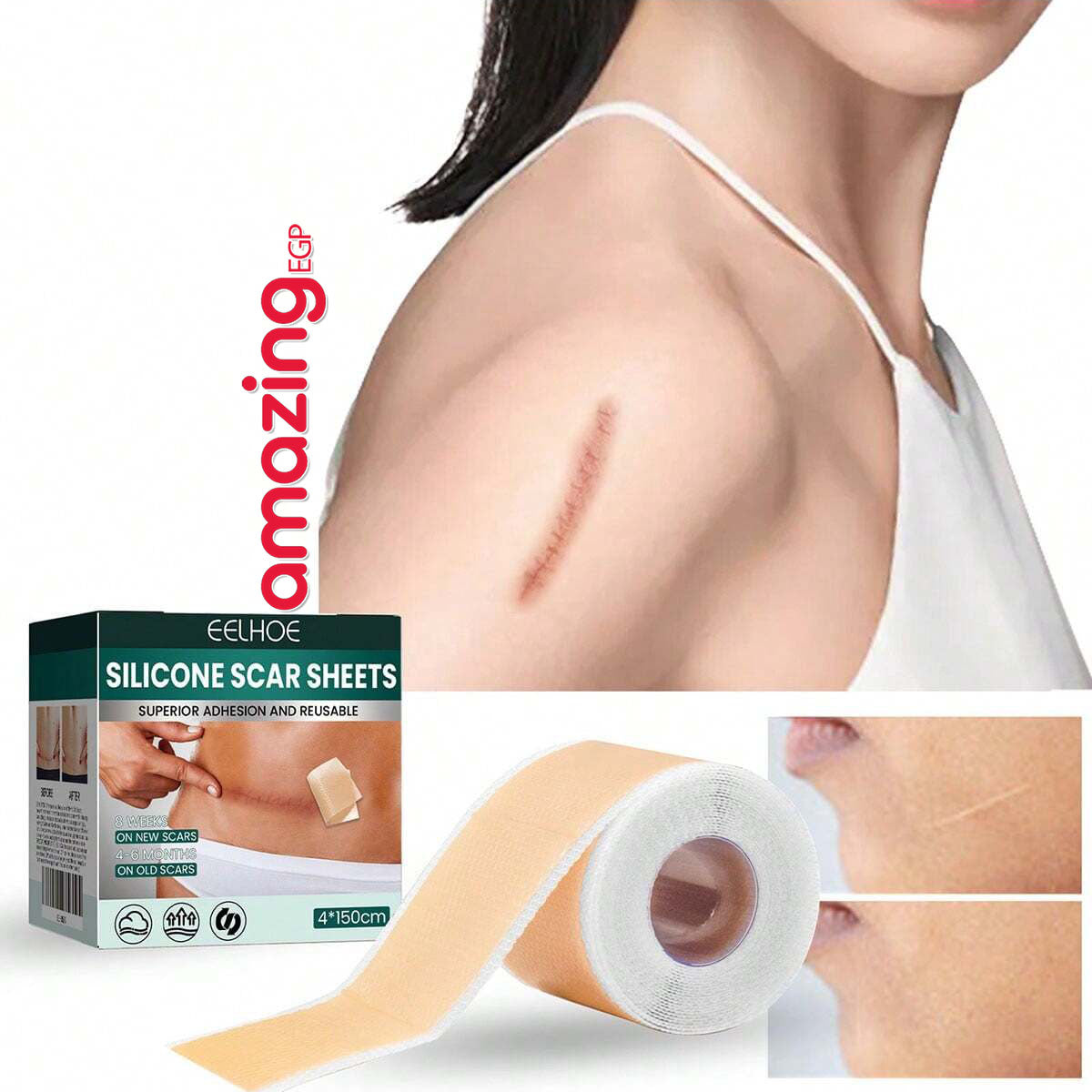 شرائح سيليكون طبية للندبات – شريط سيليكون لإزالة آثار الجروح والعمليات (4 سم × 150 سم)