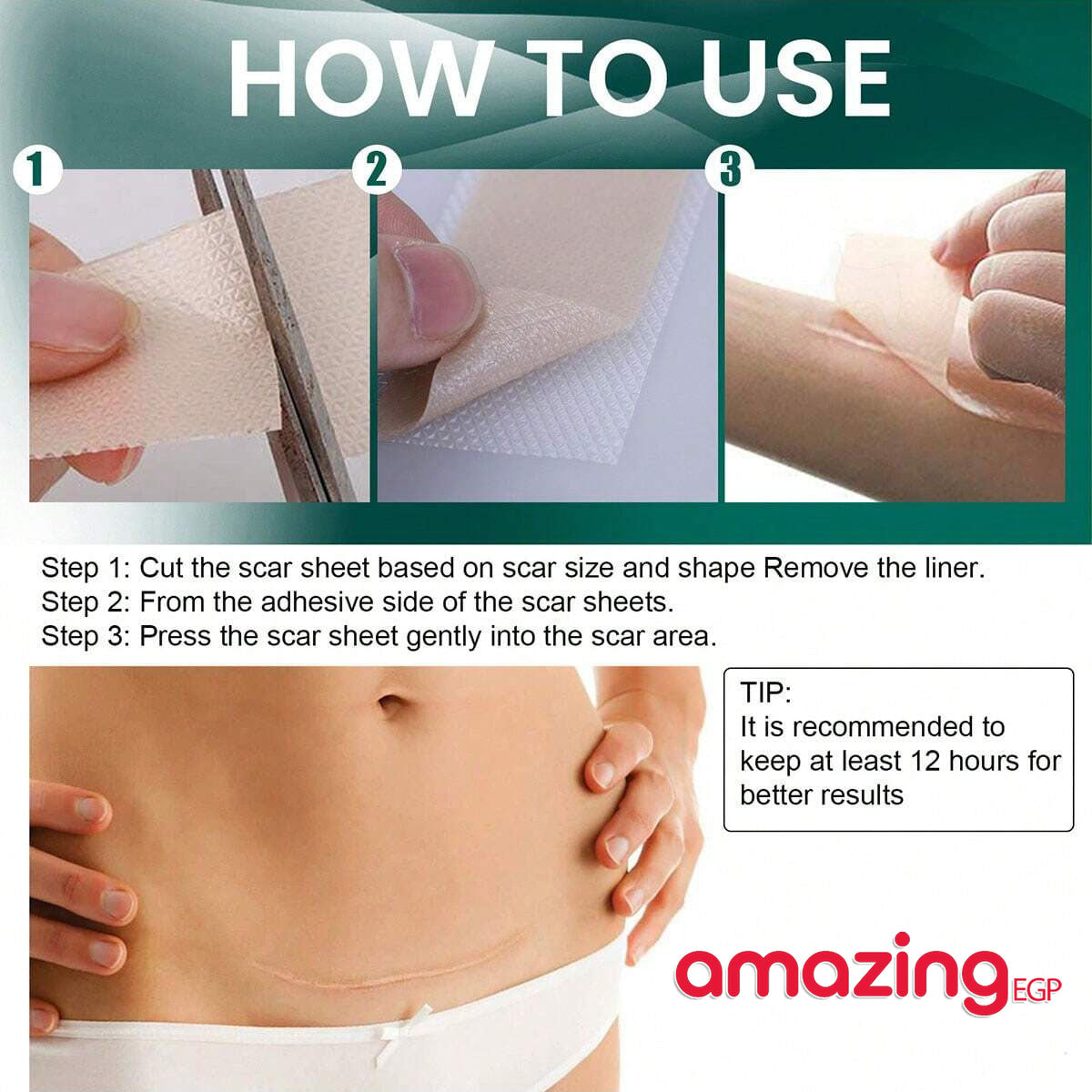 شرائح سيليكون طبية للندبات – شريط سيليكون لإزالة آثار الجروح والعمليات (4 سم × 150 سم)