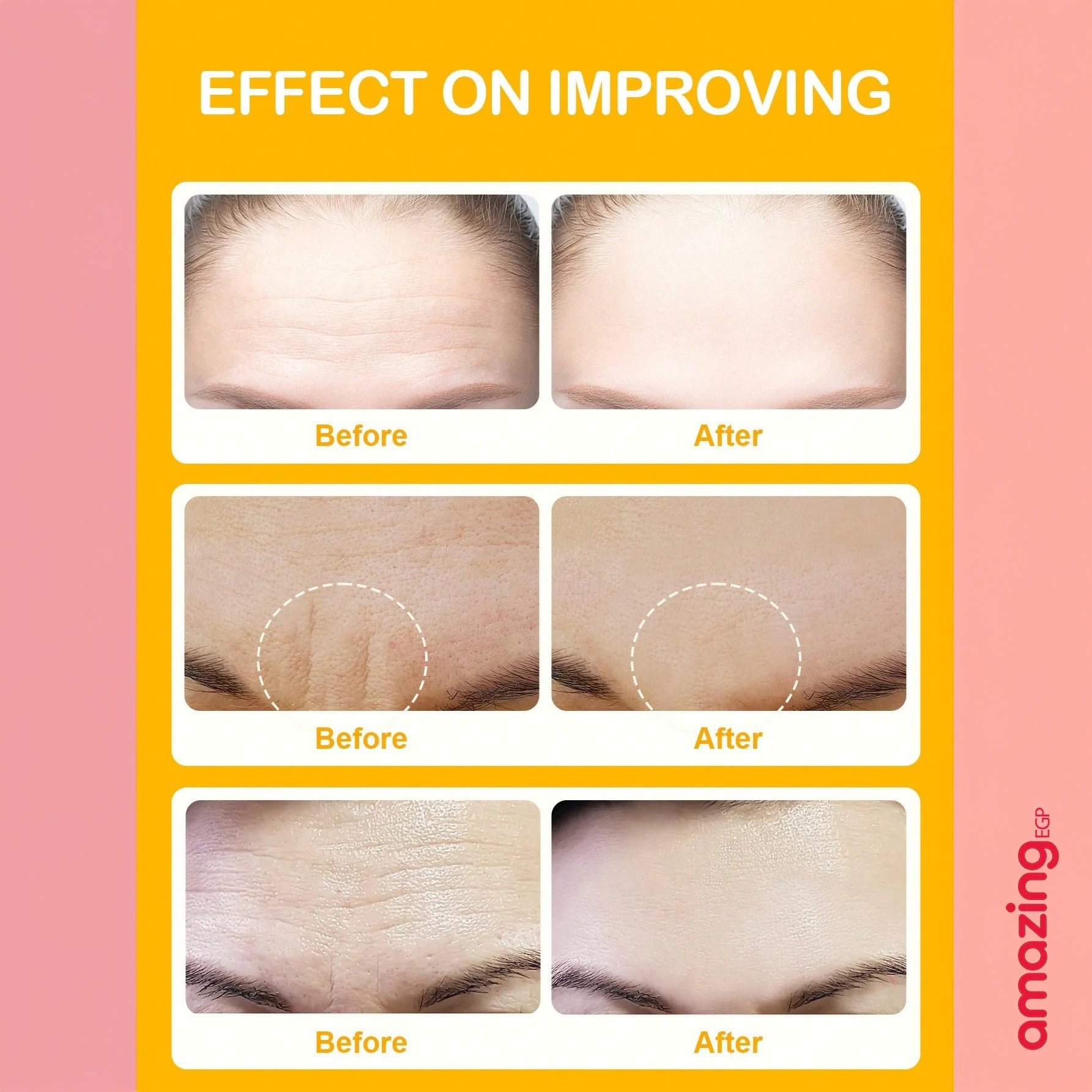 رقع علاج تجاعيد الجبهة شريط وجه للتجاعيد - رقعة الجبين - رقع مضادة للتجاعيد - رقع تجاعيد للوجه والجبهة علاج تجاعيد الوجه | SHEGLAM shein ايشادو جليتر حاجب حواجب شى ان شى كلام شي ان شي جلام ظل عيون فرشاة كونتور كونسيلر لمعة الوجة مستحضرات التجميل مكياج ميك