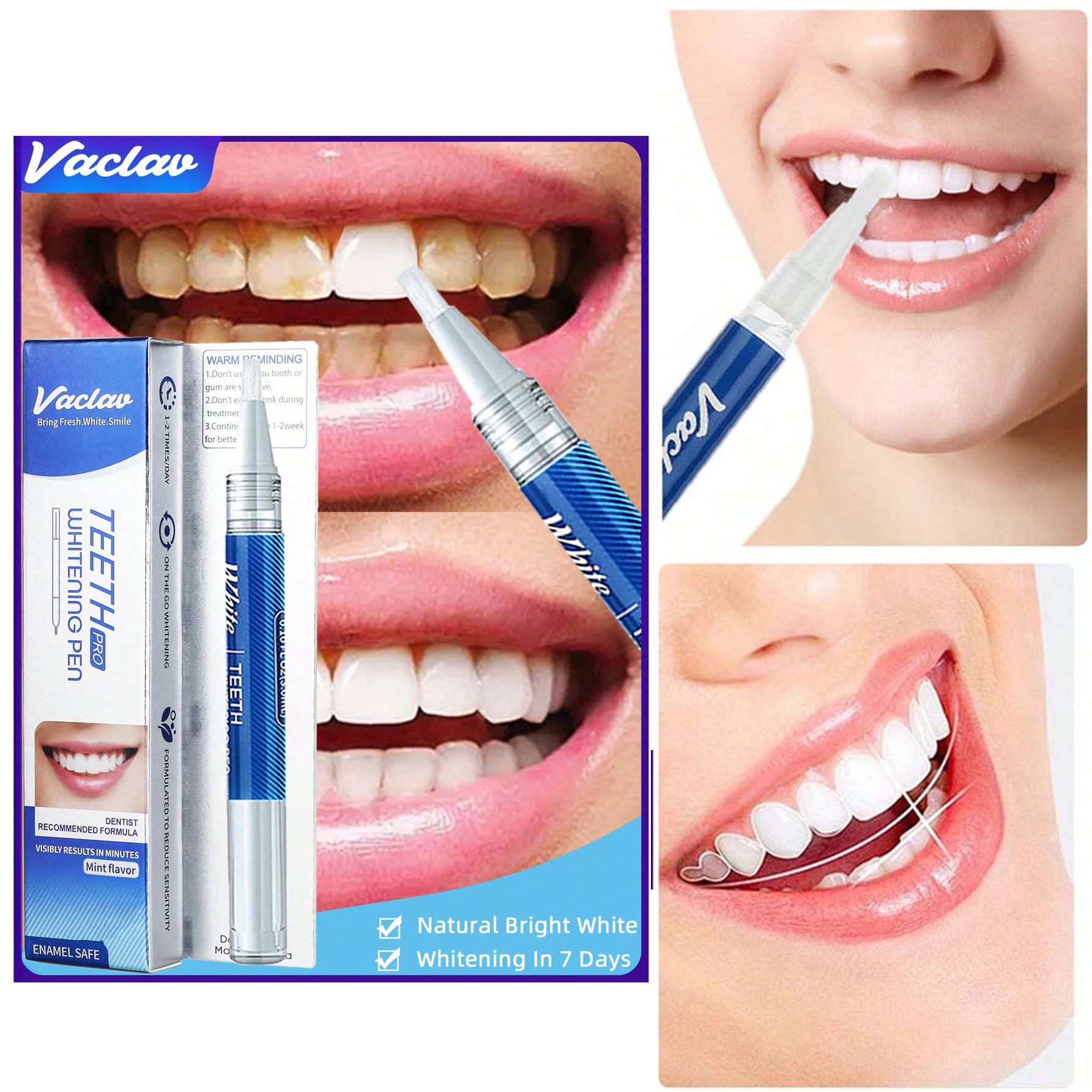 Vaclav قلم تبييض الأسنان فكلاف، جل تبييض الأسنان، جل تبييض الأسنان، يزيل البقع ويحافظ على الصحة الفموية | 1 قطعة