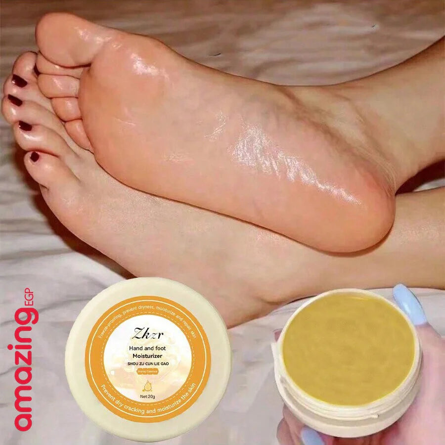 كريم اليد والقدم للبشرة المتشققة بعسل مانوكا مرطب ومرطب للأقدام الجافة كريم إصلاح الجلد المتشقق كريم إصلاح كعب القدم المتشقق | اسود الابط الباط البقع الداكنة البيكيني المناطق الحساسة تفتيح الباط تفتيح البيكيني داكن الجسم مكياج | amazingEGP