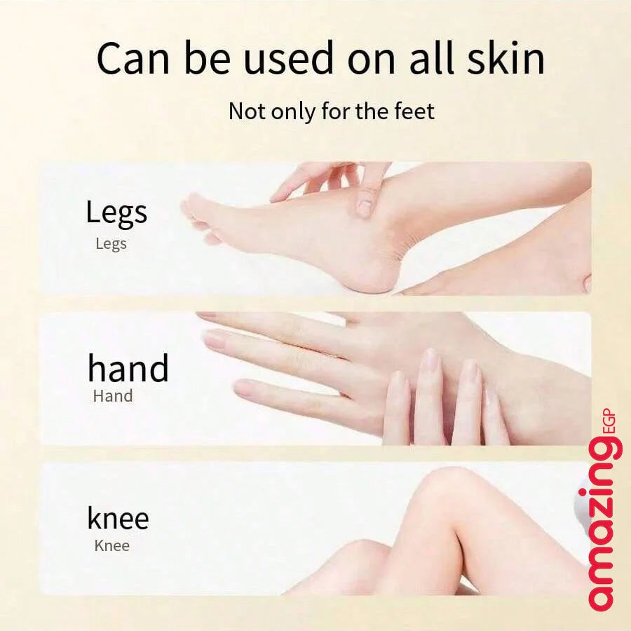كريم اليد والقدم للبشرة المتشققة بعسل مانوكا مرطب ومرطب للأقدام الجافة كريم إصلاح الجلد المتشقق كريم إصلاح كعب القدم المتشقق | اسود الابط الباط البقع الداكنة البيكيني المناطق الحساسة تفتيح الباط تفتيح البيكيني داكن الجسم مكياج | amazingEGP