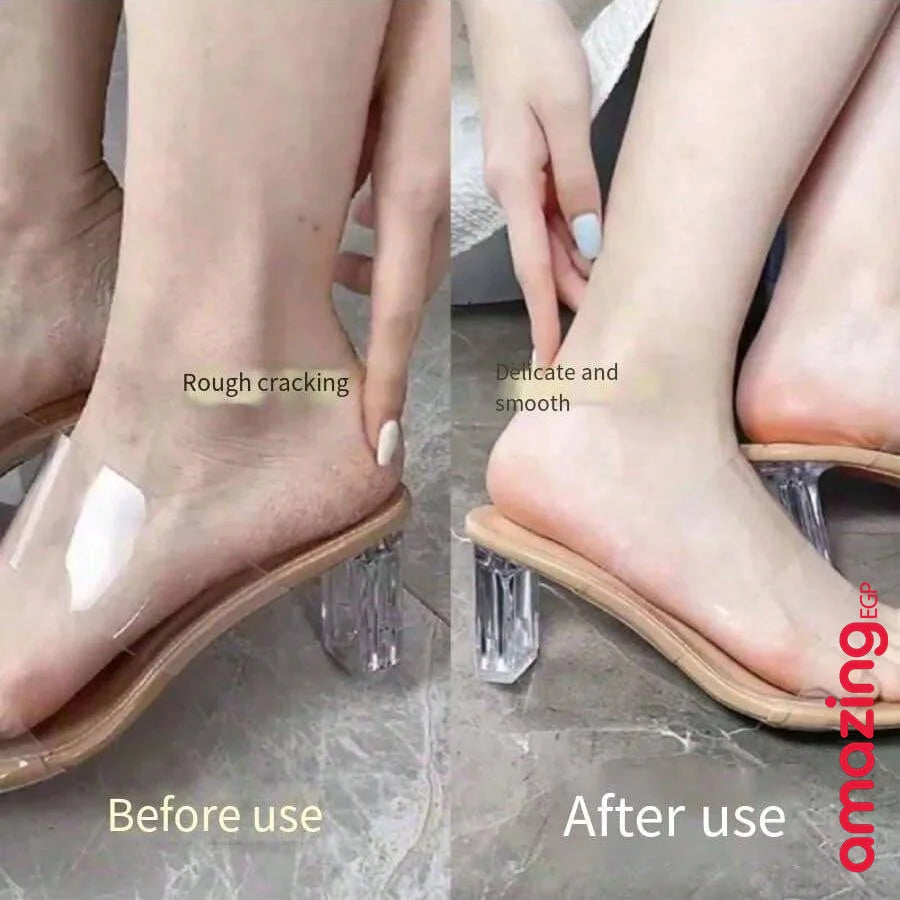 كريم اليد والقدم للبشرة المتشققة بعسل مانوكا مرطب ومرطب للأقدام الجافة كريم إصلاح الجلد المتشقق كريم إصلاح كعب القدم المتشقق | اسود الابط الباط البقع الداكنة البيكيني المناطق الحساسة تفتيح الباط تفتيح البيكيني داكن الجسم مكياج | amazingEGP