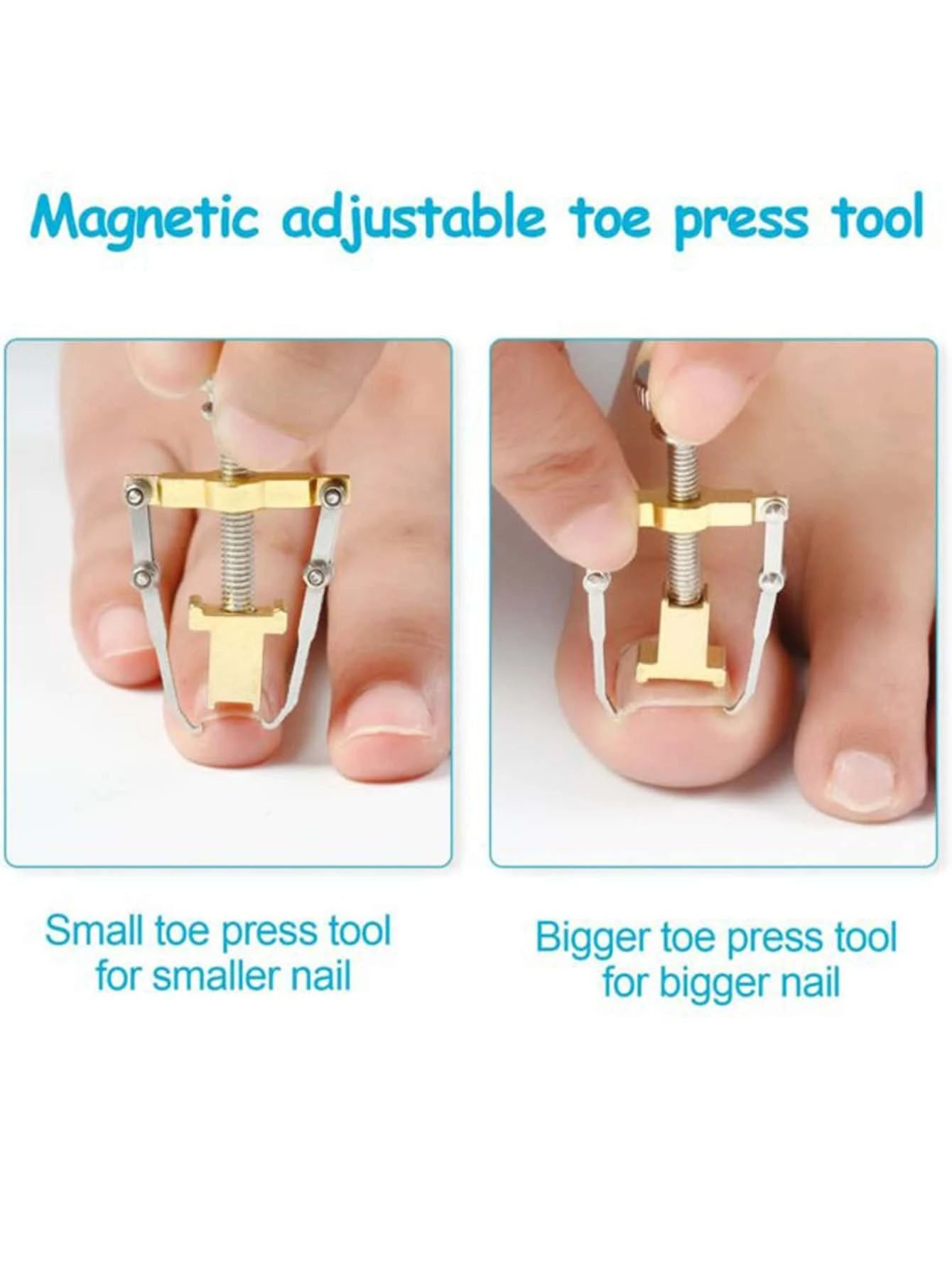 مصحح الأظافر النامية من الجلد،  مجموعة أدوات معالجة أصابع اليدين والقدمين (مصحح الأظافر النامية)