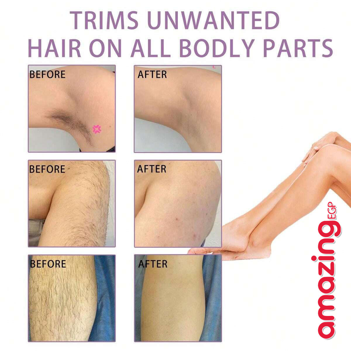 جهاز إزالة الشعر الكهربائي المحمول للوجه والجسم – إبيلاتور لاسلكي صغير بلمسة ذهبية، بدون ألم ومقاوم للماء