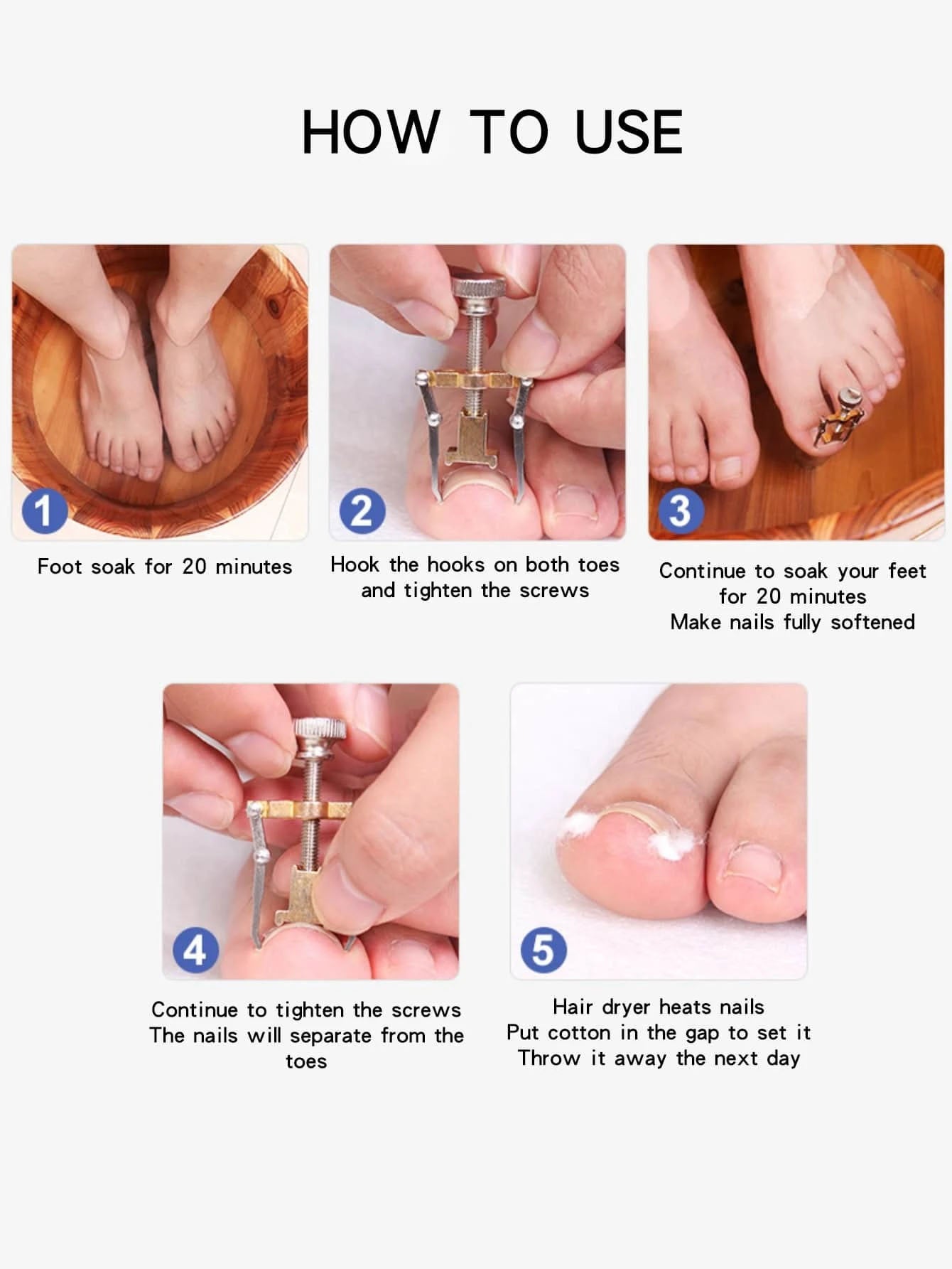 مصحح الأظافر النامية من الجلد،  مجموعة أدوات معالجة أصابع اليدين والقدمين (مصحح الأظافر النامية)