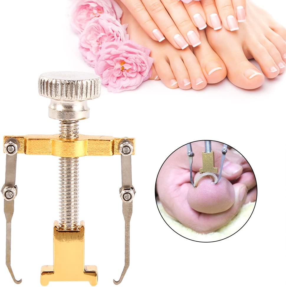 مصحح الأظافر النامية من الجلد،  مجموعة أدوات معالجة أصابع اليدين والقدمين (مصحح الأظافر النامية)
